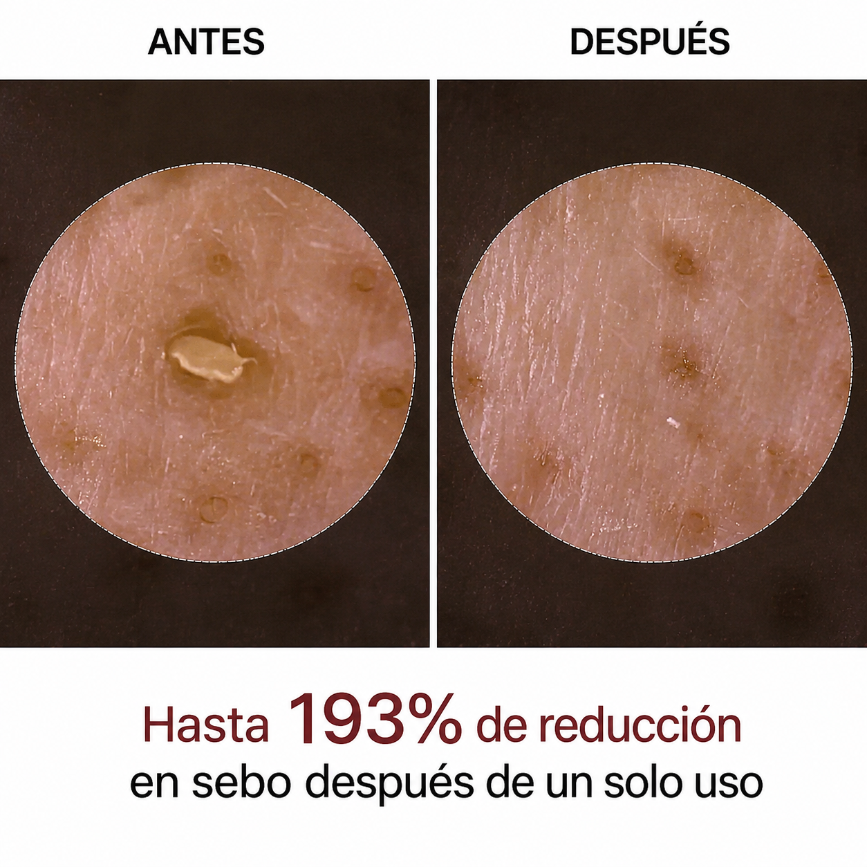 Cuidado peeling coreano – Elimina las impurezas y realza tu piel